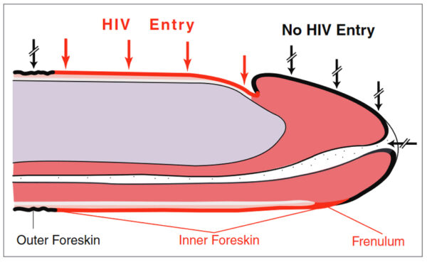 HIV entry foreskin